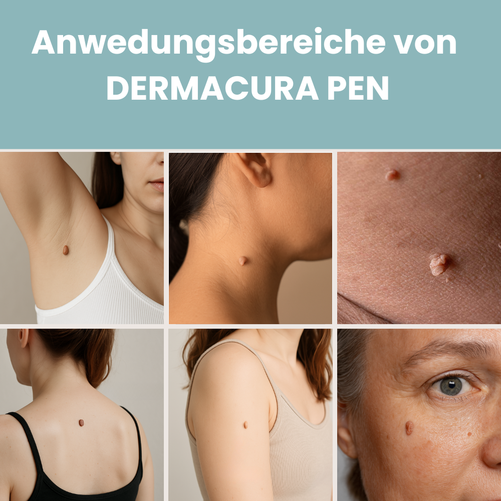 Dermacura Pen